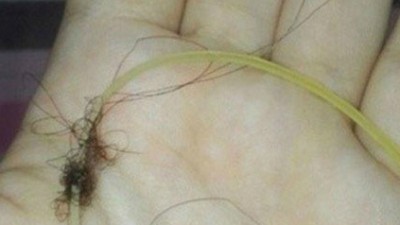여자들만 아는 아픔…남자들은 몰라?