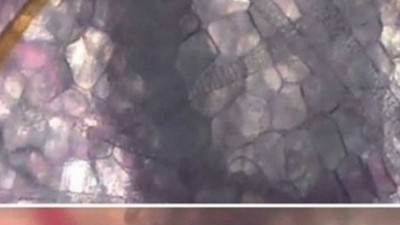 모기가 무는 순간…“나도 어제 저렇게 당했겠지”