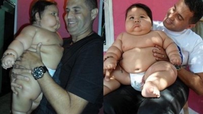 생후 8개월에 6살 체중…‘슈퍼 베이비’